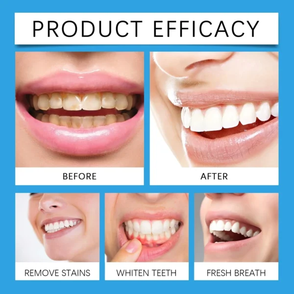 Teeth Whitening Powder | Whitening and Stain Removal - Image 4