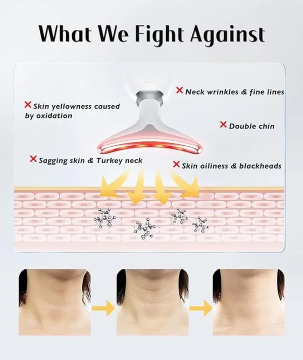 Lifting And Firming Facial Massage Device - Image 3