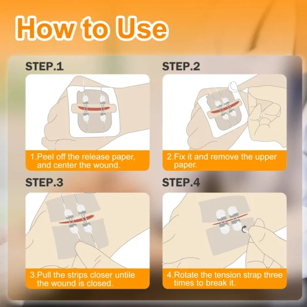Wound Closure Device-4PCS - Image 4