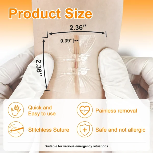 Wound Closure Device-4PCS - Image 5