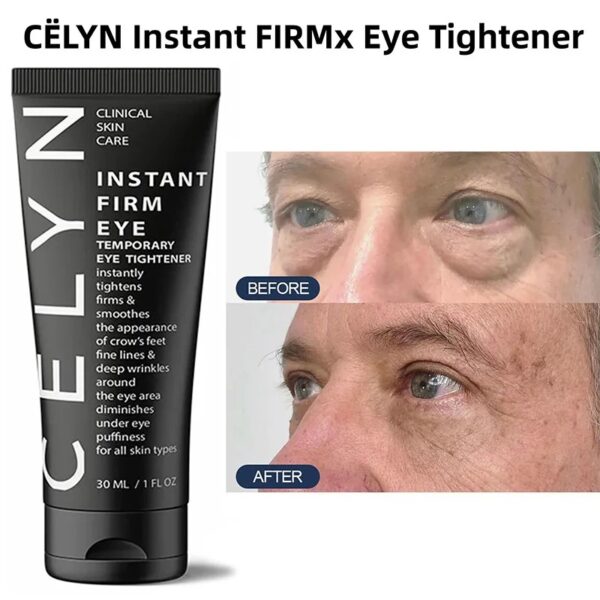 Firm Eye Tightener - Image 5
