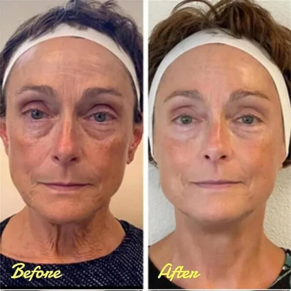 Firm Eye Tightener - Image 6