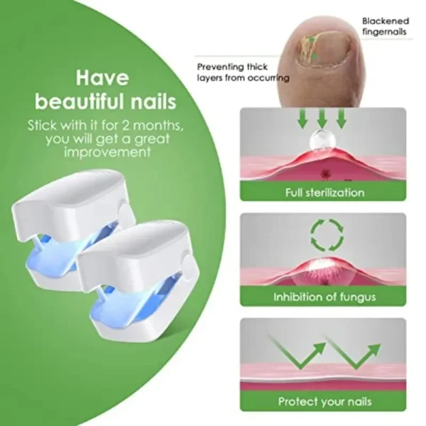 Light Therapy Device For Toenail Diseases - Image 2