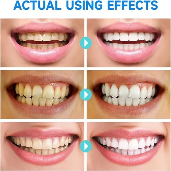 Niacinamide Whitening Toothpaste - Image 7