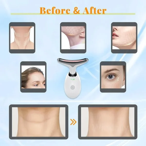 Anti Wrinkle Facial Massager - Image 4