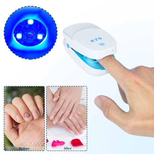 Antifungal Laser Device - Image 6