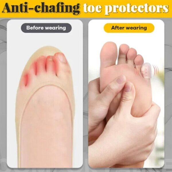 Silicone Anti-friction Toe Protector - Image 2