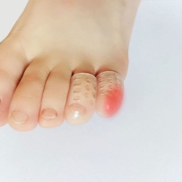 Silicone Anti-friction Toe Protector - Image 5
