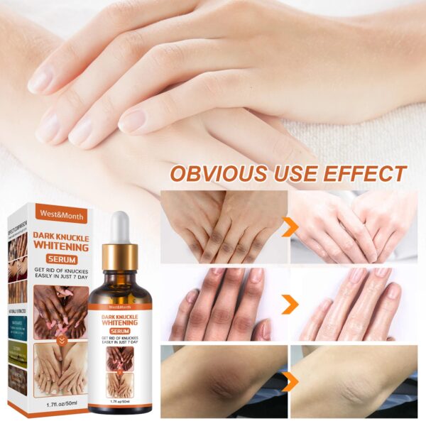 Acanthosis Nigricans Therapy Oil - Image 5