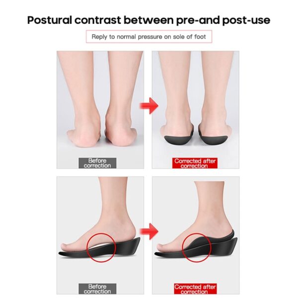 Flat Foot Orthopedic Insoles - Image 6