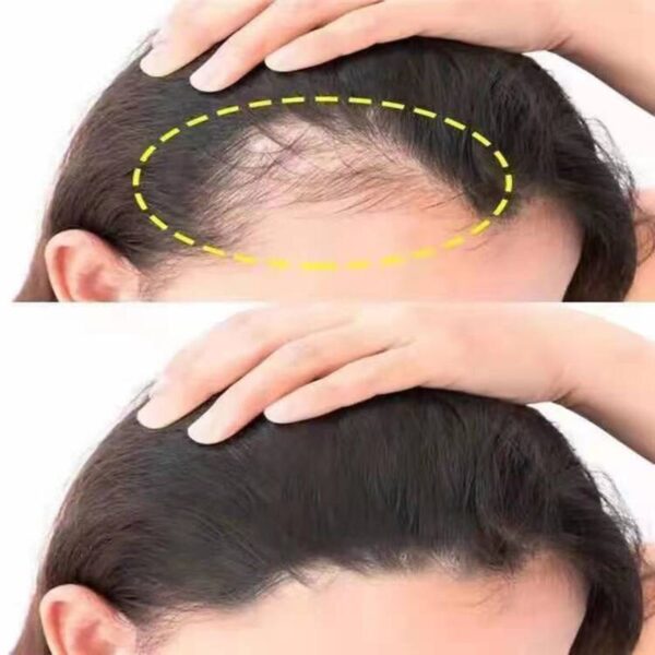 Korean Ginseng HairReborn SerumSpray - Image 3