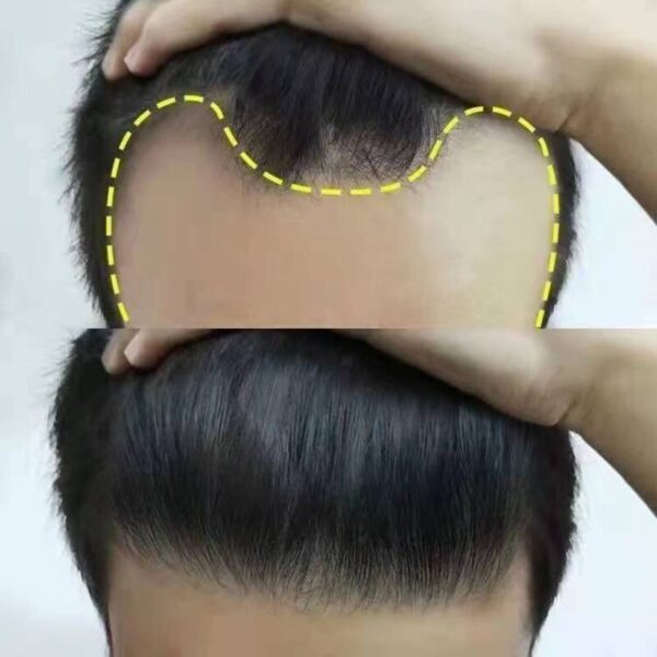 Korean Ginseng HairReborn SerumSpray - Image 4