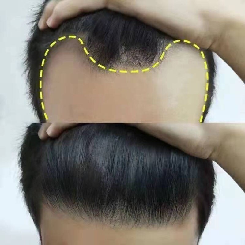 Korean Ginseng HairReborn SerumSpray - Image 4