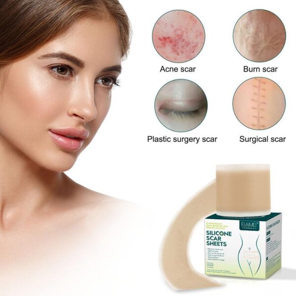 Medical Soft Silicone Gel Tape for Scar Removal - Image 2