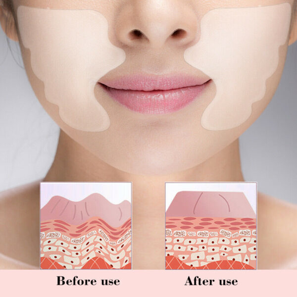 Reusable Silicone Patches - Image 3