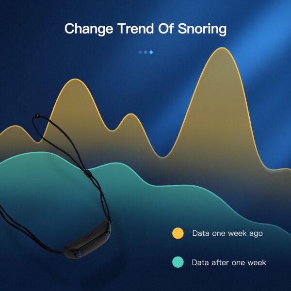 SleepRex Generation II Smart Anti Snoring Apnea Device - Image 4