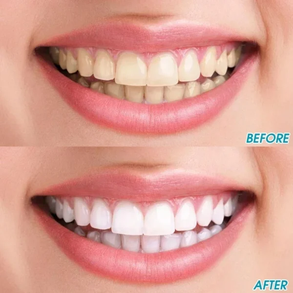 Tooth Stain Cleaning Brush-3PCS - Image 2