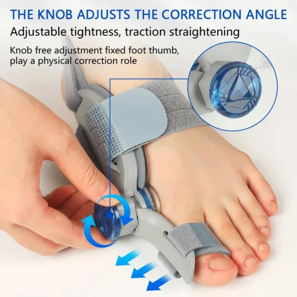Bunion Fix - Image 2