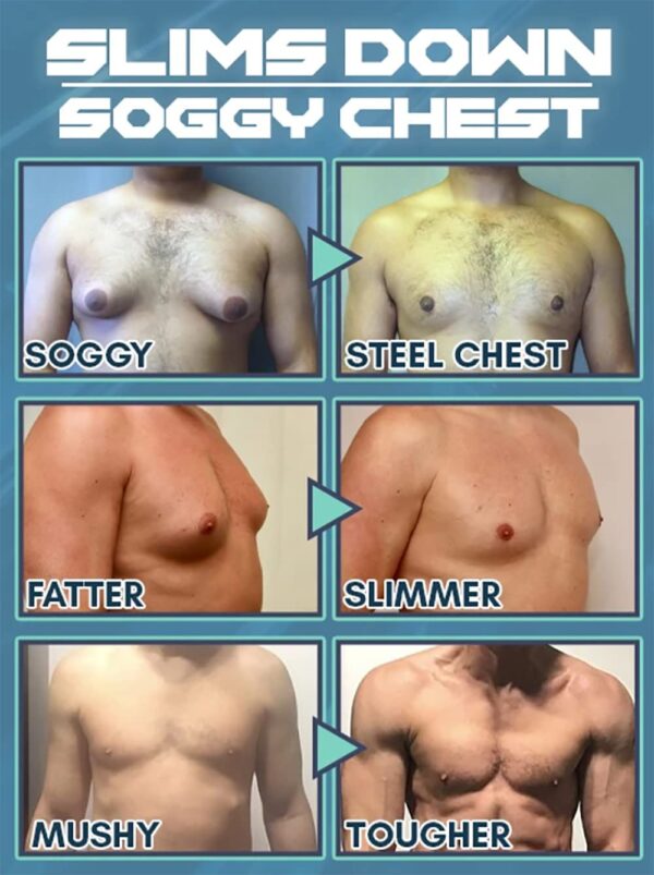 Gynecomastia Reduction Cellulite Spray - Image 2