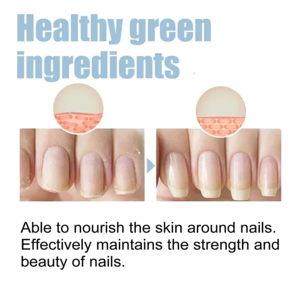 OnyxoGuard Nail Growth and Repair Serum - Image 4