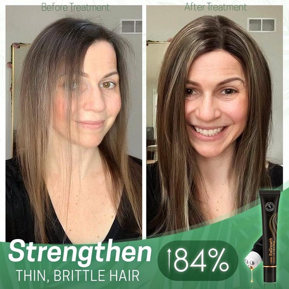 Organic Hair Serum Roller - Image 2