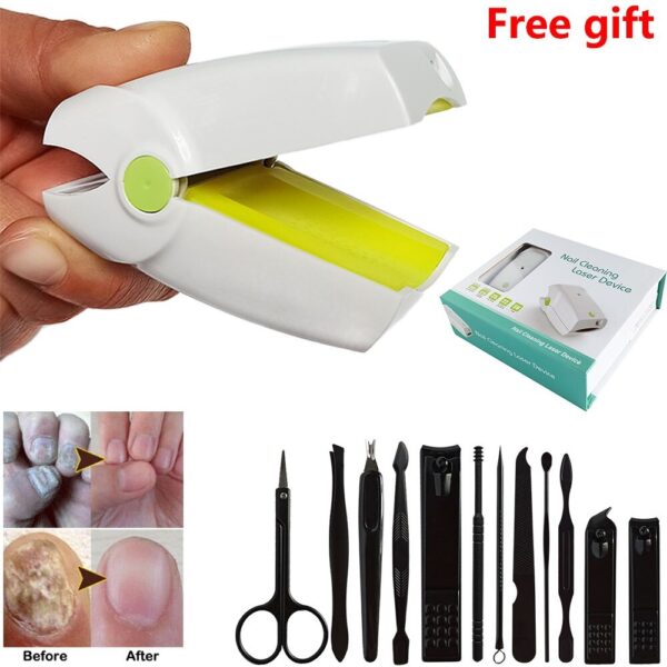 Portable Fungus Nail Laser - Image 3