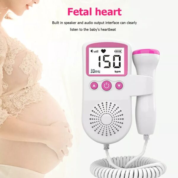 Prenatal Fetal Doppler