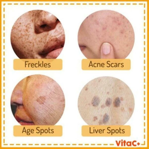 Instant Blemish Removal Gel - Image 2