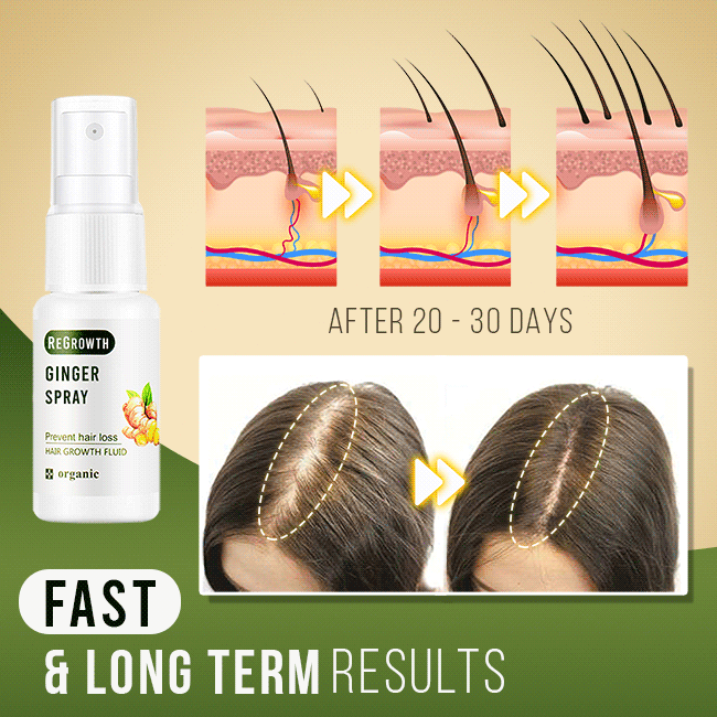 ReGrowth Ginger Spray - Image 4