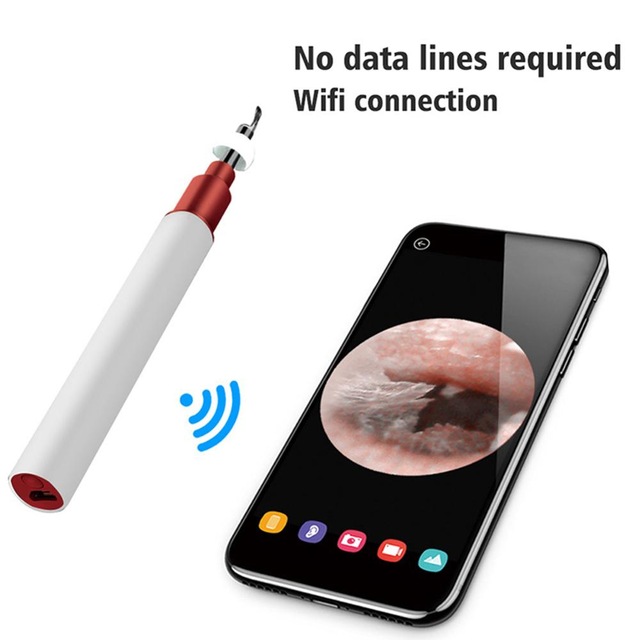 1080P WiFi Home Endoscope - Image 3