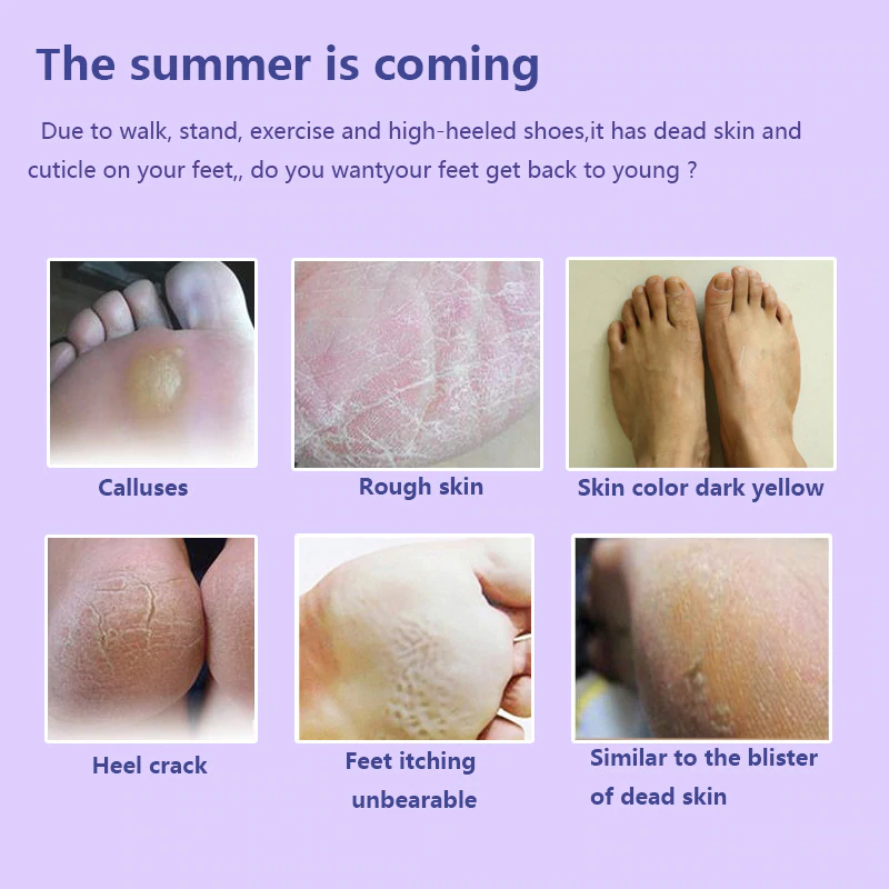 Deep Hydration Lavender Foot Peeling mask - Image 3