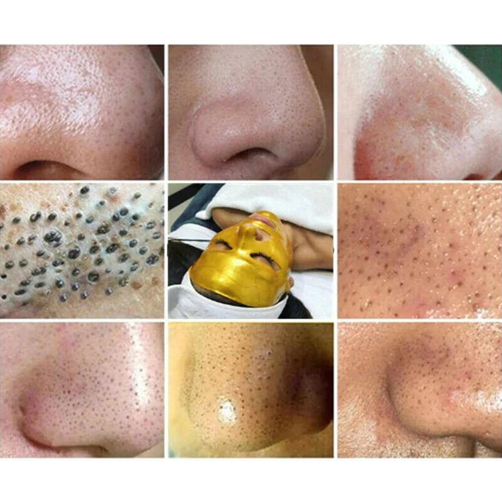 Gold Peel-Off Mask - Image 3