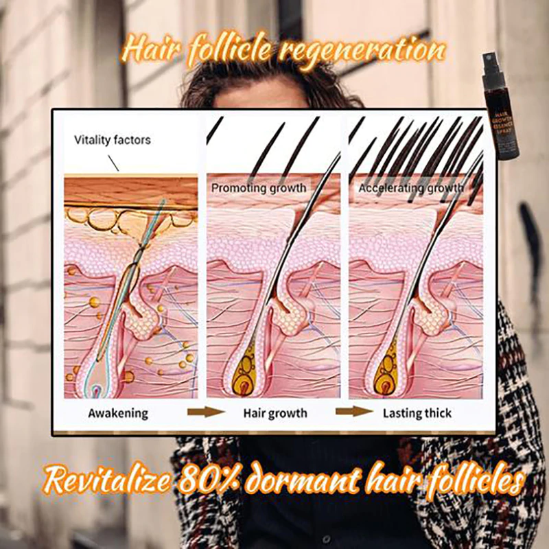 Hair Regrowth Essence Intensive Spray - Image 5