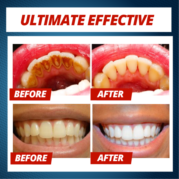 Natural Intensive Stain Remover Whitening Toothpaste - Image 5