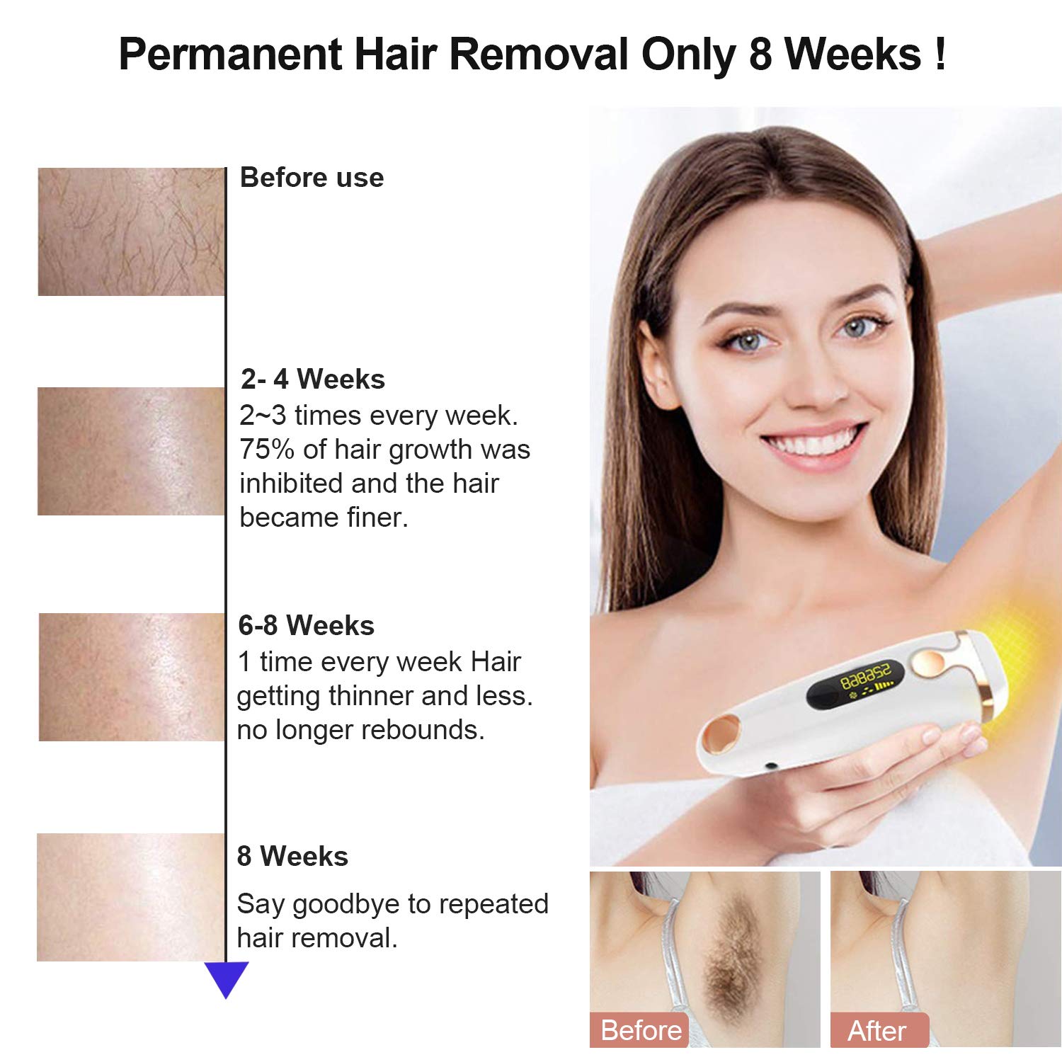 Silk Touch Pro™ IPL Hair Removal Device - Image 2