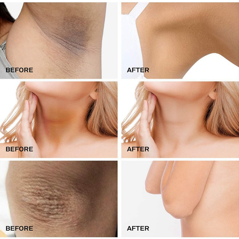 Whitener Intimate Bleach Body Cream - Image 5