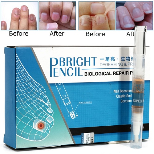 Eucony Fast Acting Toenail Cure - 3ml (PACK OF 4)