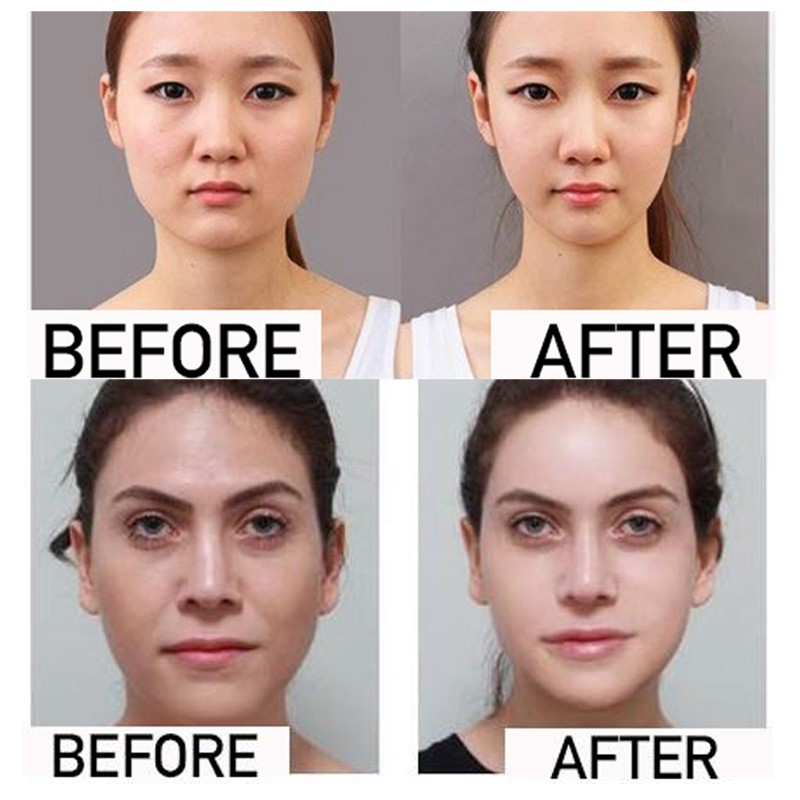 Miracle V-Shaped Slimming Mask - Image 2