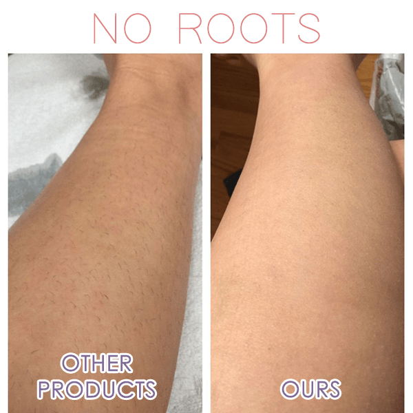 Perfect Hair Remover - Image 2