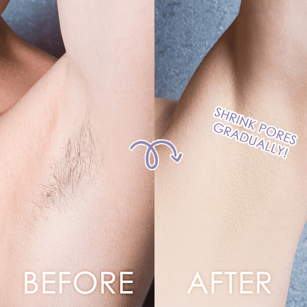 Perfect Hair Remover - Image 3